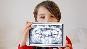 What Do Dental X Rays Show? A Guide, Dental Radiography, HD wallpaper